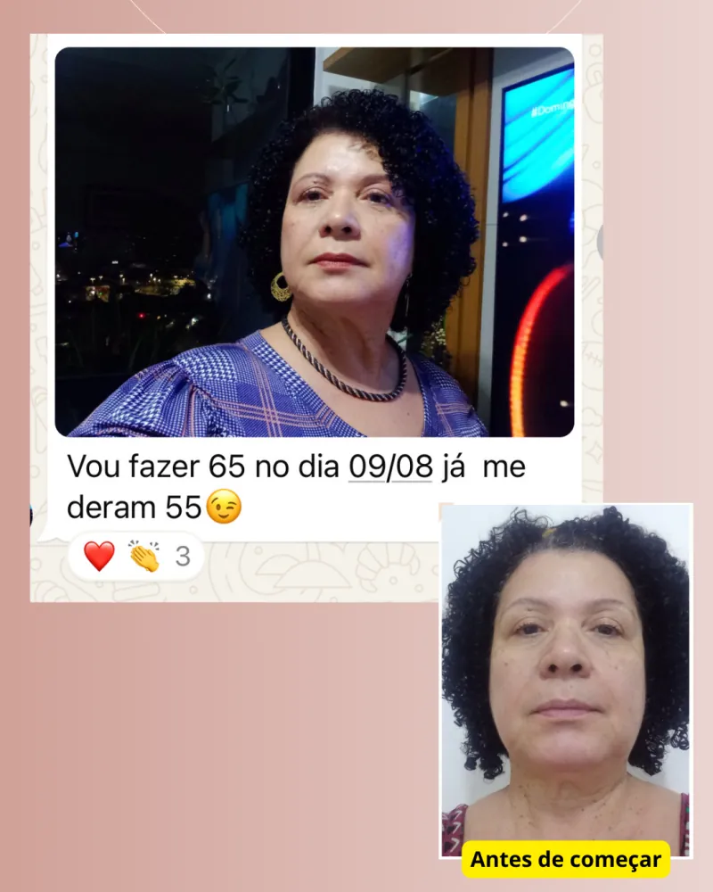 Antes e depois