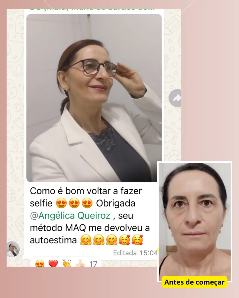 Antes e depois