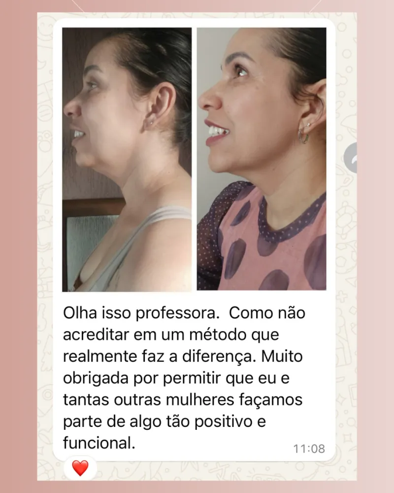 Antes e depois