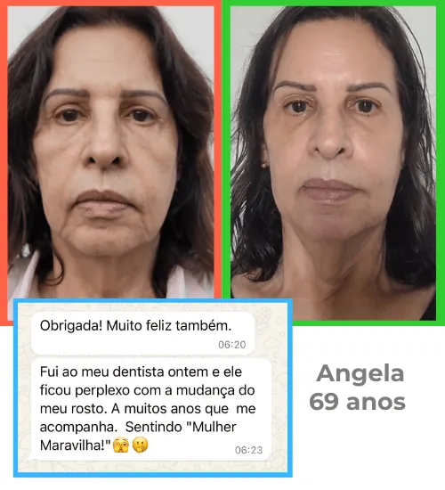 Antes e depois da Angélica