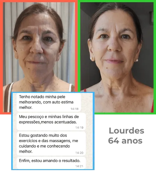 Antes e depois