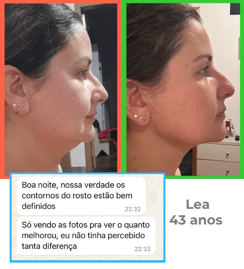 Antes e depois